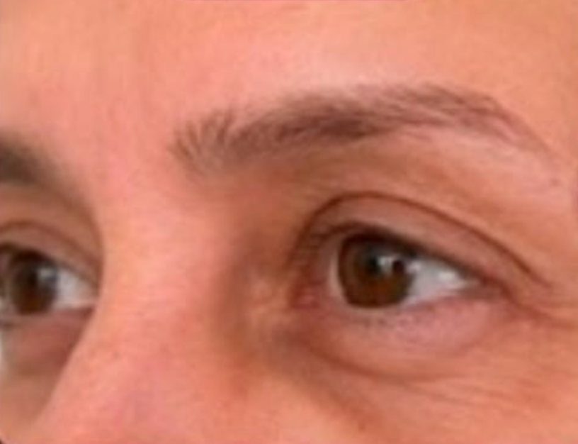 Antes